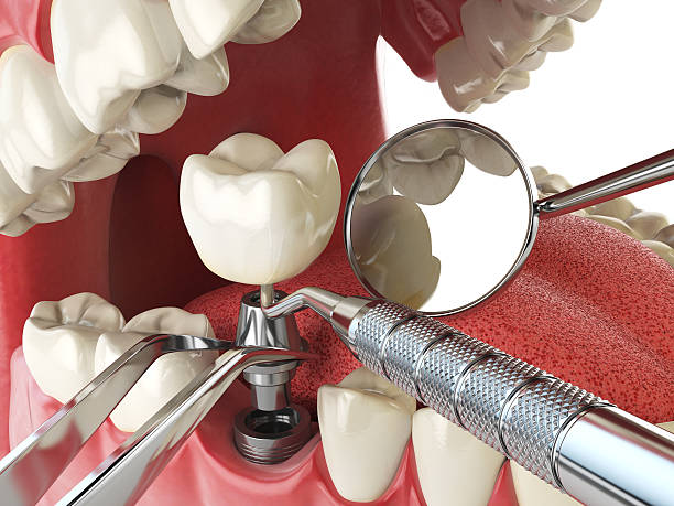 Best Broken or Cracked Tooth Emergency Dentist in Avonia, PA